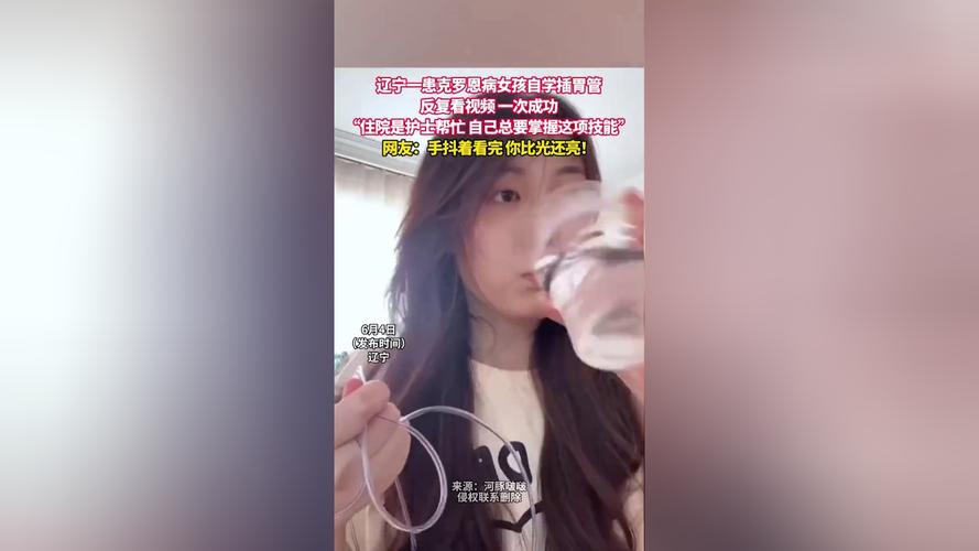 新澳今天晚上9点30分358期-百度和00后女孩自学插胃管与00后女孩自学插胃管视频